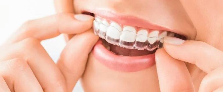 Straighter Smile in Windsor ON