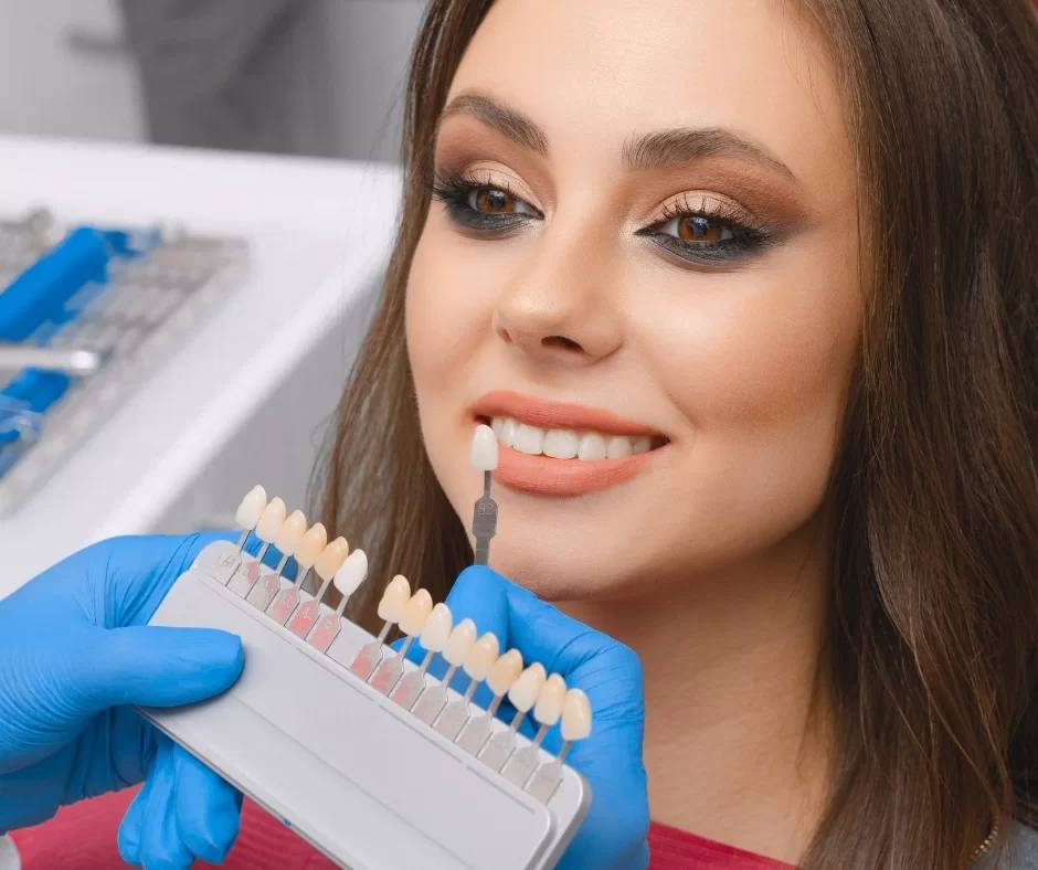 affordable veneers near me Windsor ON