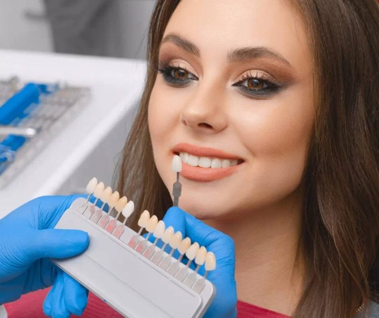 affordable veneers near me Windsor